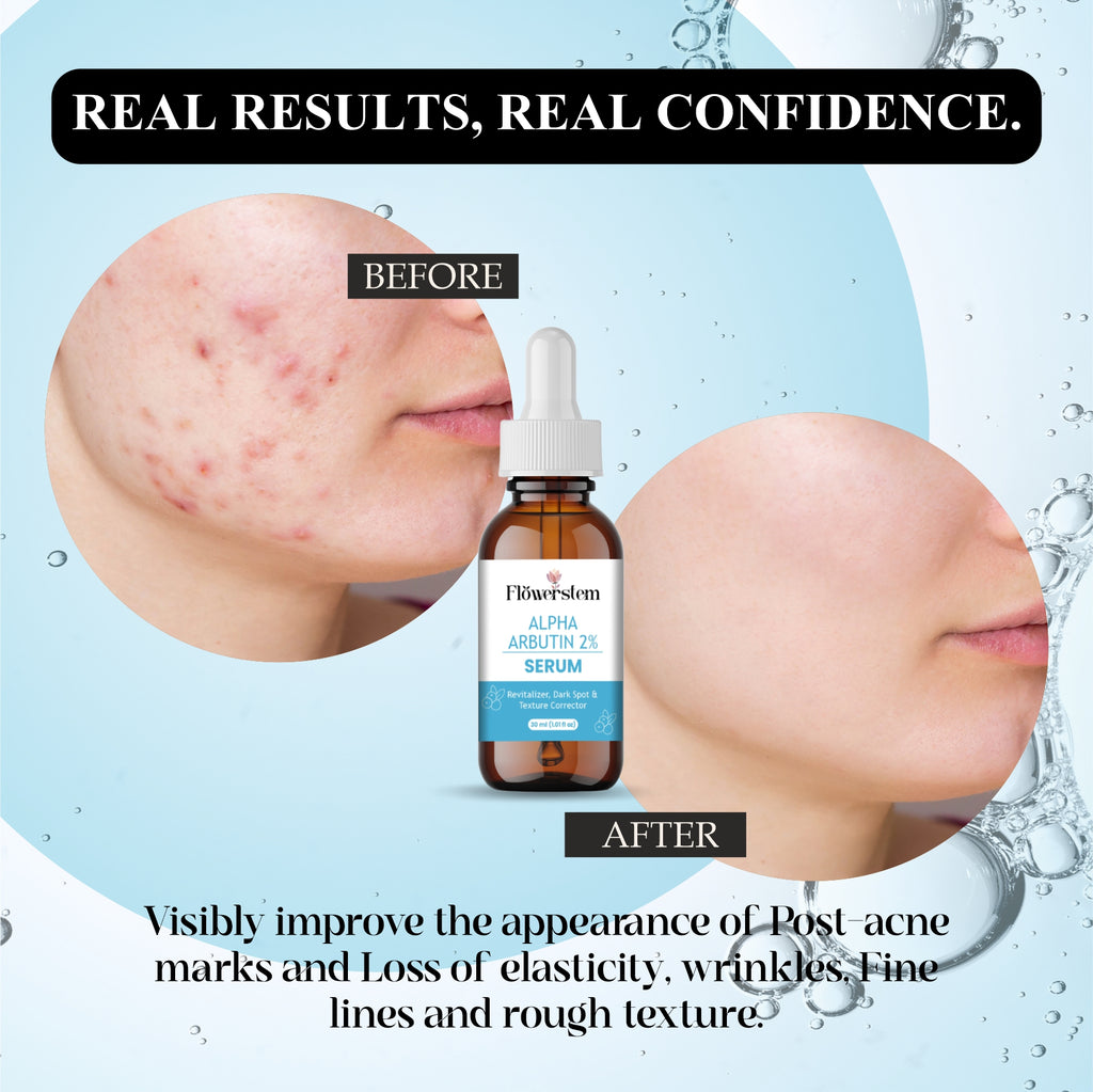 Alpha Arbutin Serum for Skin Brightening | Dark Spot Remover | Even Skin Tone & Radiance | Lightweight, Fast Absorbing Face Serum