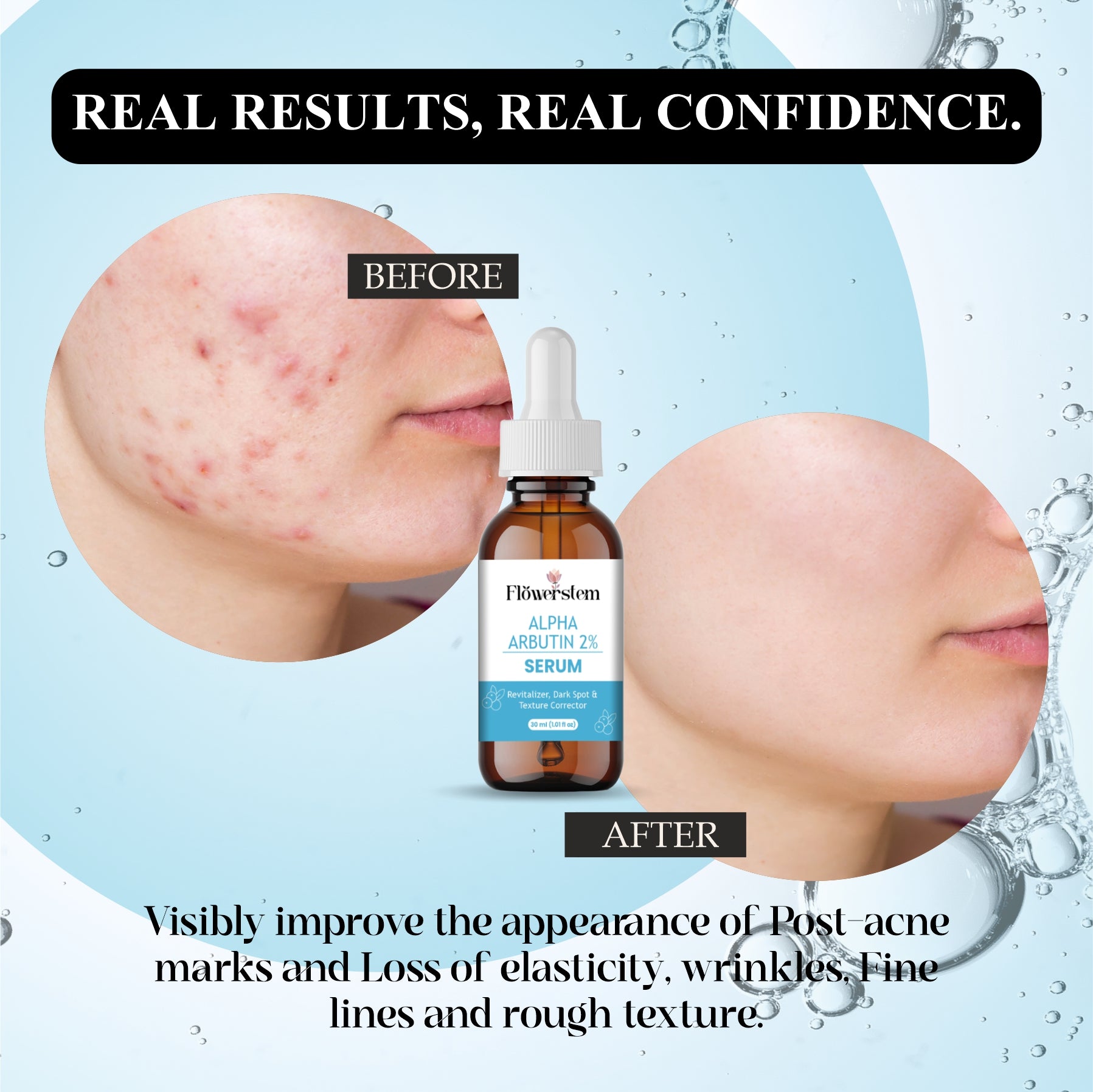 Alpha Arbutin Serum for Skin Brightening | Dark Spot Remover | Even Skin Tone & Radiance | Lightweight, Fast Absorbing Face Serum