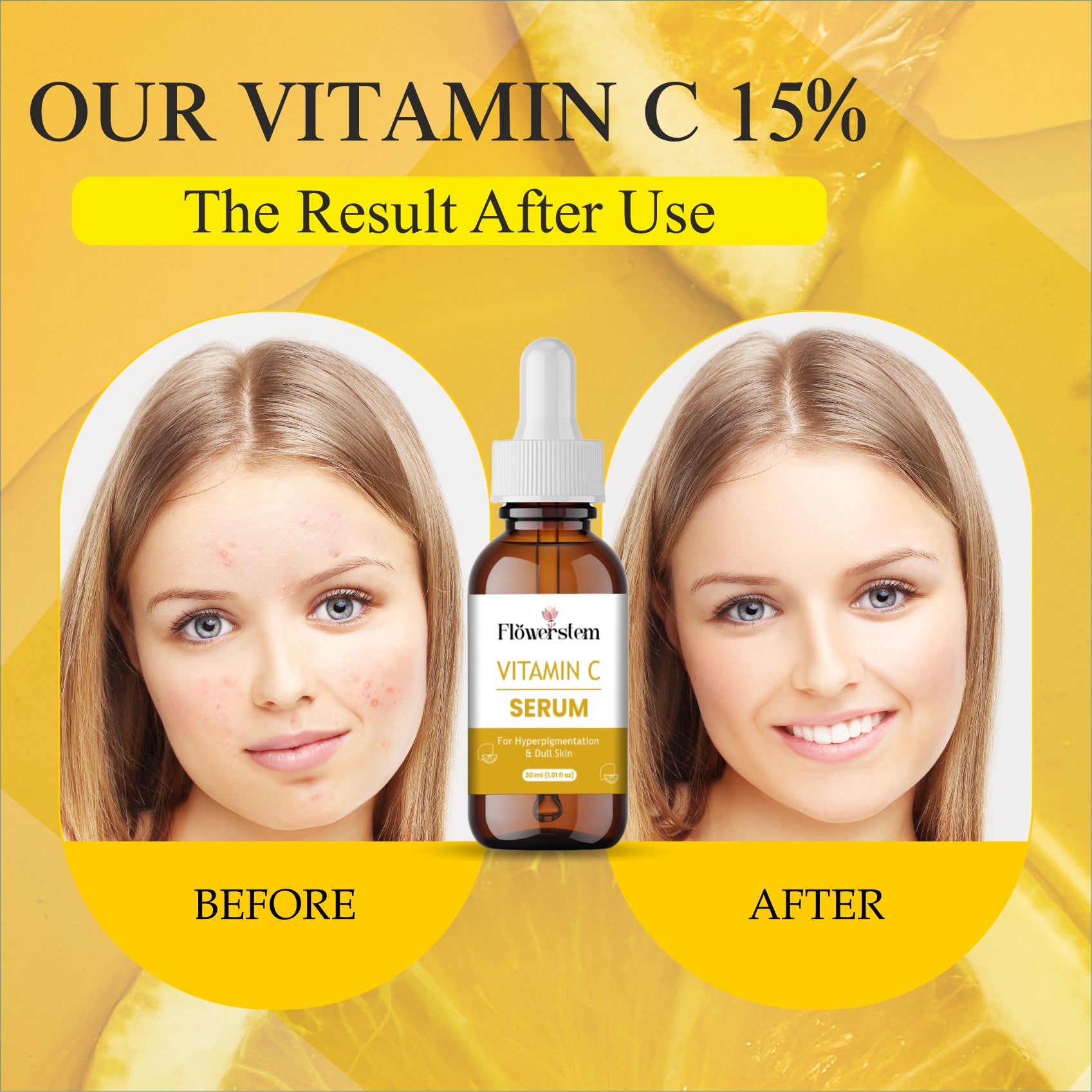 Vitamin C Face Serum for Glowing Skin | Brightening & Anti-Aging Serum with Hyaluronic Acid & Vitamin E | Fades Dark Spots, Evens Skin Tone, Reduces Fine Lines | For Men & Women – 30ml