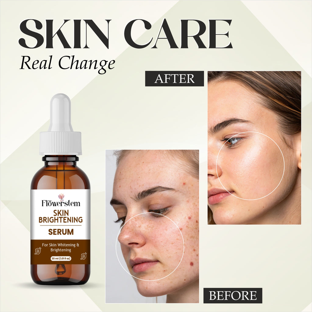 Skin Brightening Serum with Vitamin C, Niacinamide & Hyaluronic Acid | Dark Spot Corrector | Evens Skin Tone | Hydrating Face Serum for Radiant & Glowing Skin – 30ml