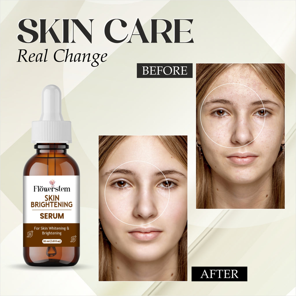 Skin Brightening Serum with Vitamin C, Niacinamide & Hyaluronic Acid | Dark Spot Corrector | Evens Skin Tone | Hydrating Face Serum for Radiant & Glowing Skin – 30ml