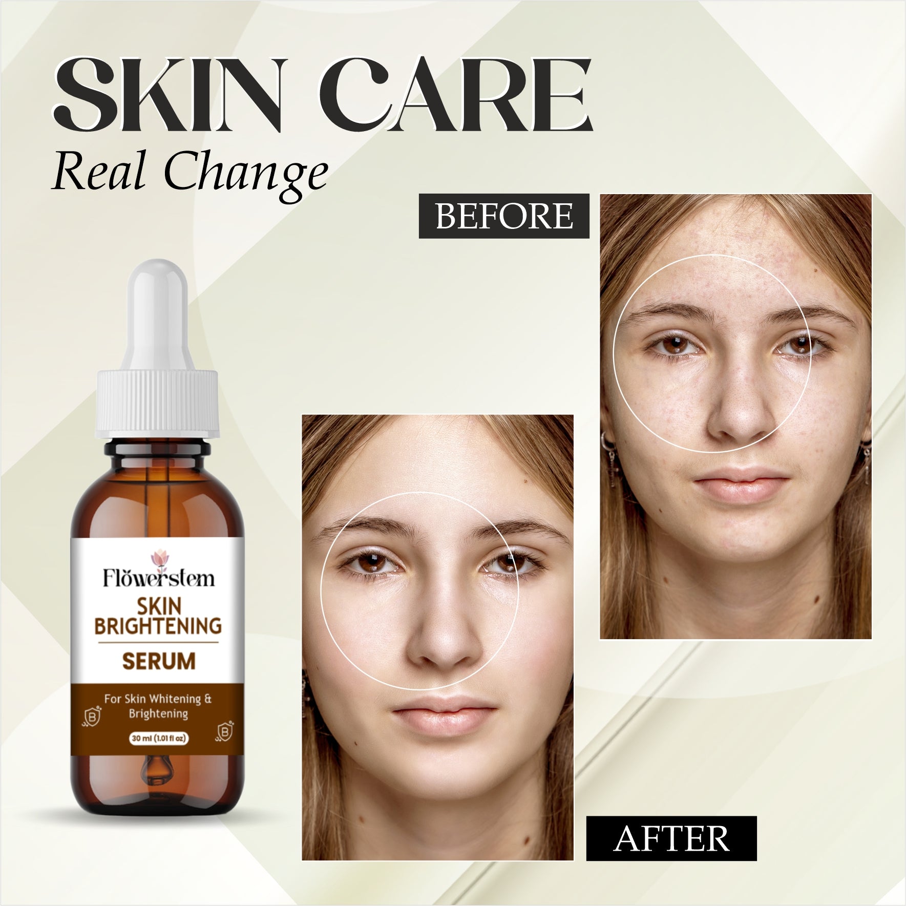 Skin Brightening Serum with Vitamin C, Niacinamide & Hyaluronic Acid | Dark Spot Corrector | Evens Skin Tone | Hydrating Face Serum for Radiant & Glowing Skin – 30ml