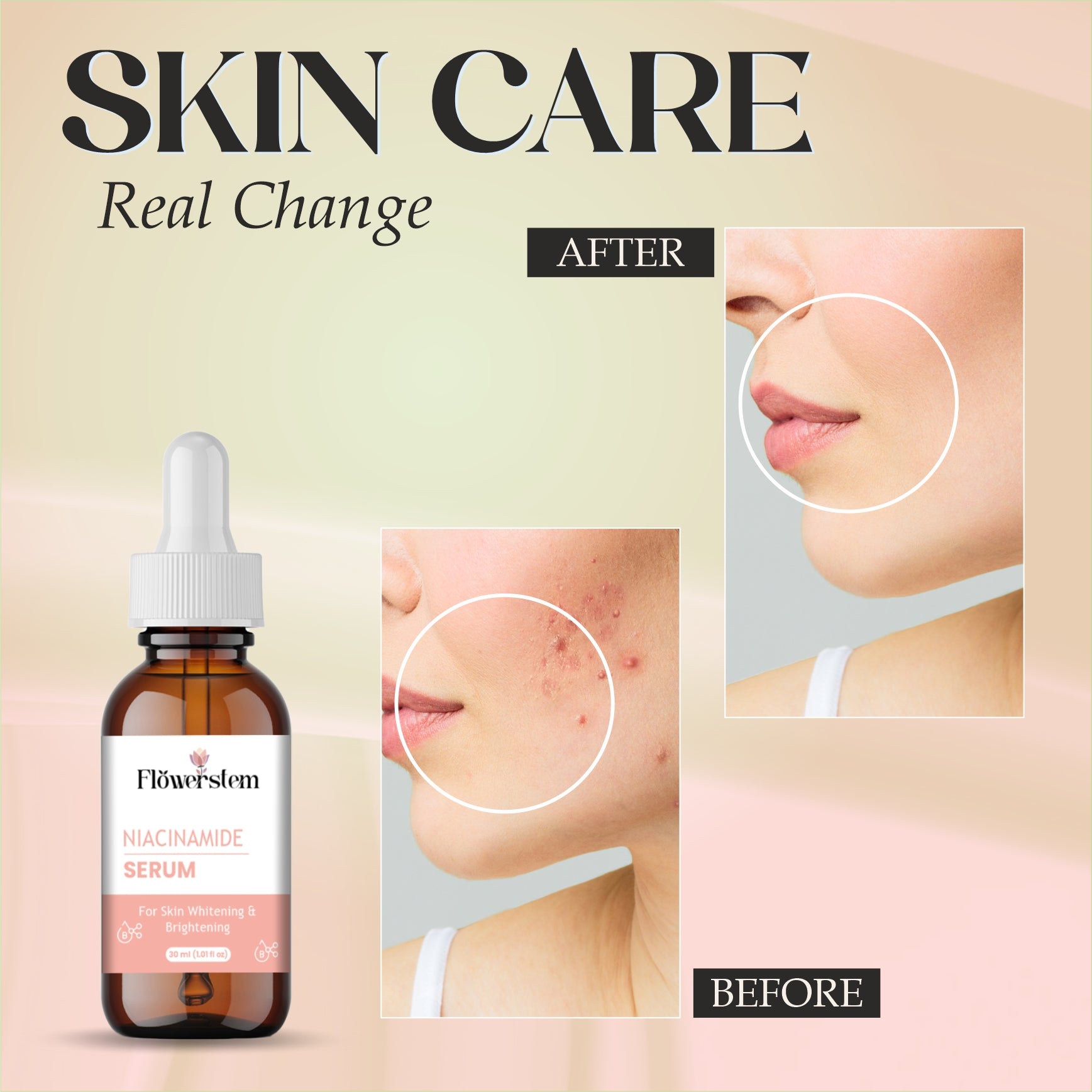 Niacinamide Serum 10% for Face | Reduces Acne Marks, Dark Spots & Oiliness | Brightening & Hydrating Face Serum for Clear, Even-Toned Skin | Lightweight, Non-Sticky Formula