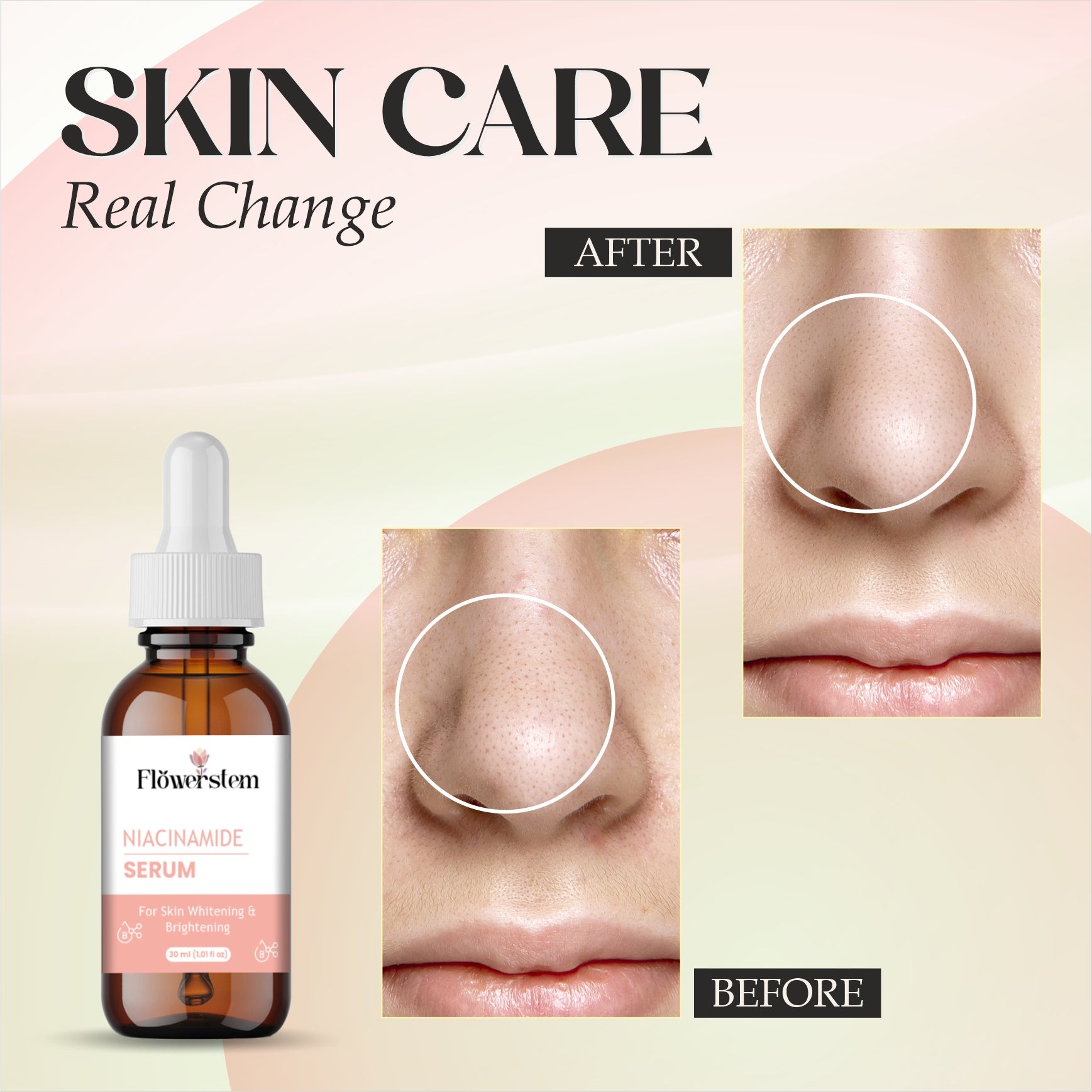 Niacinamide Serum 10% for Face | Reduces Acne Marks, Dark Spots & Oiliness | Brightening & Hydrating Face Serum for Clear, Even-Toned Skin | Lightweight, Non-Sticky Formula